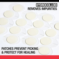 Neutrogena Stubborn Acne Ultra-Thin Patches for Acne-Prone Skin - Hydrocolloid Overnight Blemish Patch for Clear Skin, 24 Patches